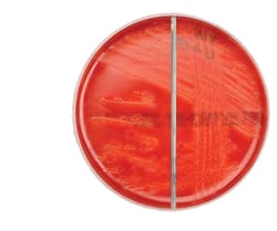 Thermo Scientific A.R.I.A. Medium with 5% Horse Blood/A.R.I.A. Medium with 5% Horse Blood and Neomycin Biplate | Buy Online | Thermo Scientific&trade; | Fisher Scientific